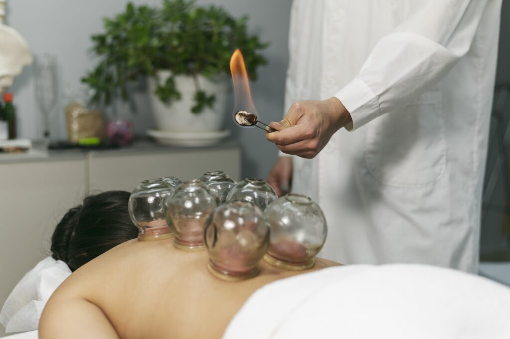 Cupping therapy session showing cups applied to the back to promote healing and cupping therapy benefits.